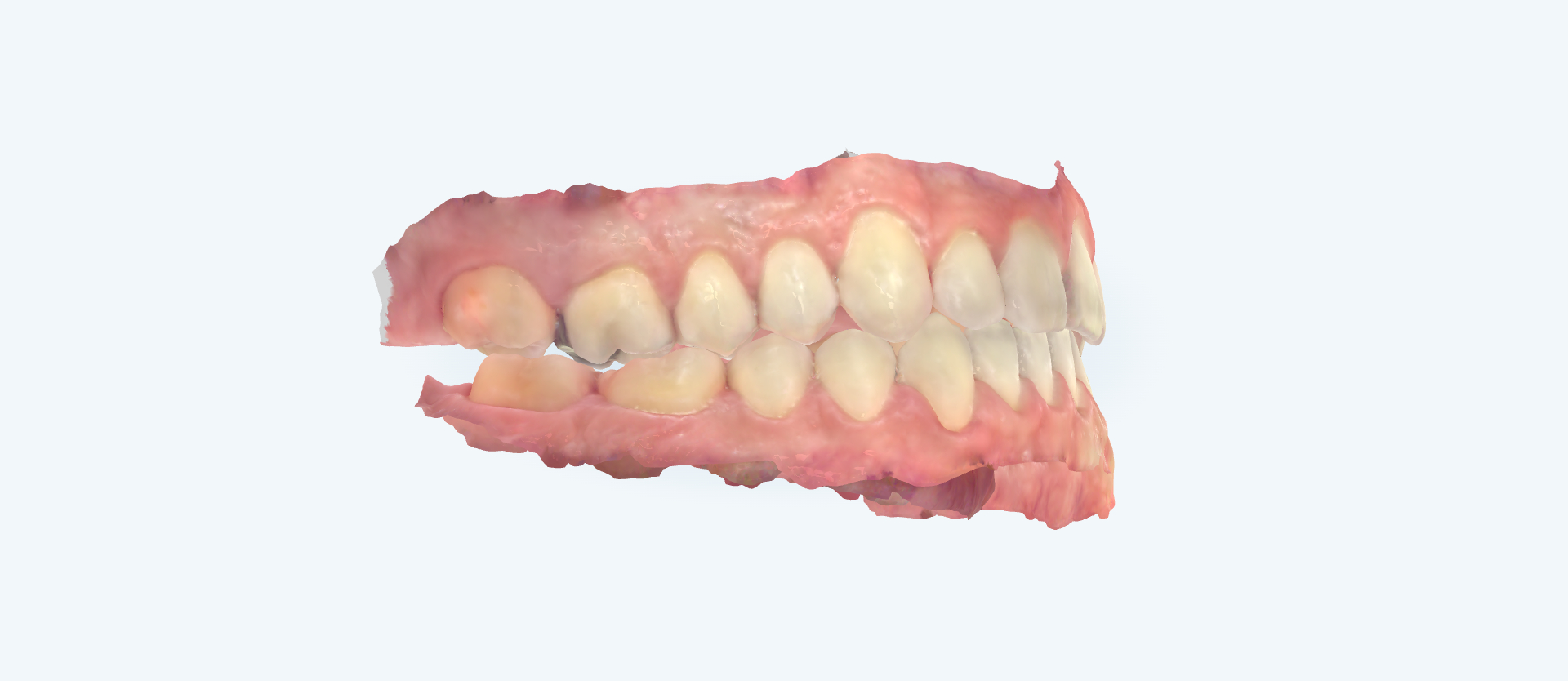 Featured orthodontic smile transformation